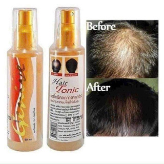 Serum Xịt Kích Thích Mọc Tóc Genive Thái Lan!!