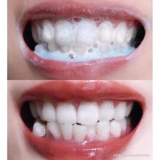 Cao tẩy răng thái lan chính hãng