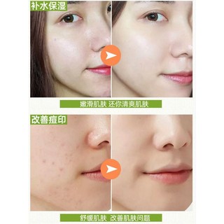 [ 𝗚𝗶𝗮́ 𝘀𝗶̉ ] Mặt Nạ B5 MINJYN  Phục Hồi Da Cấp Tốc