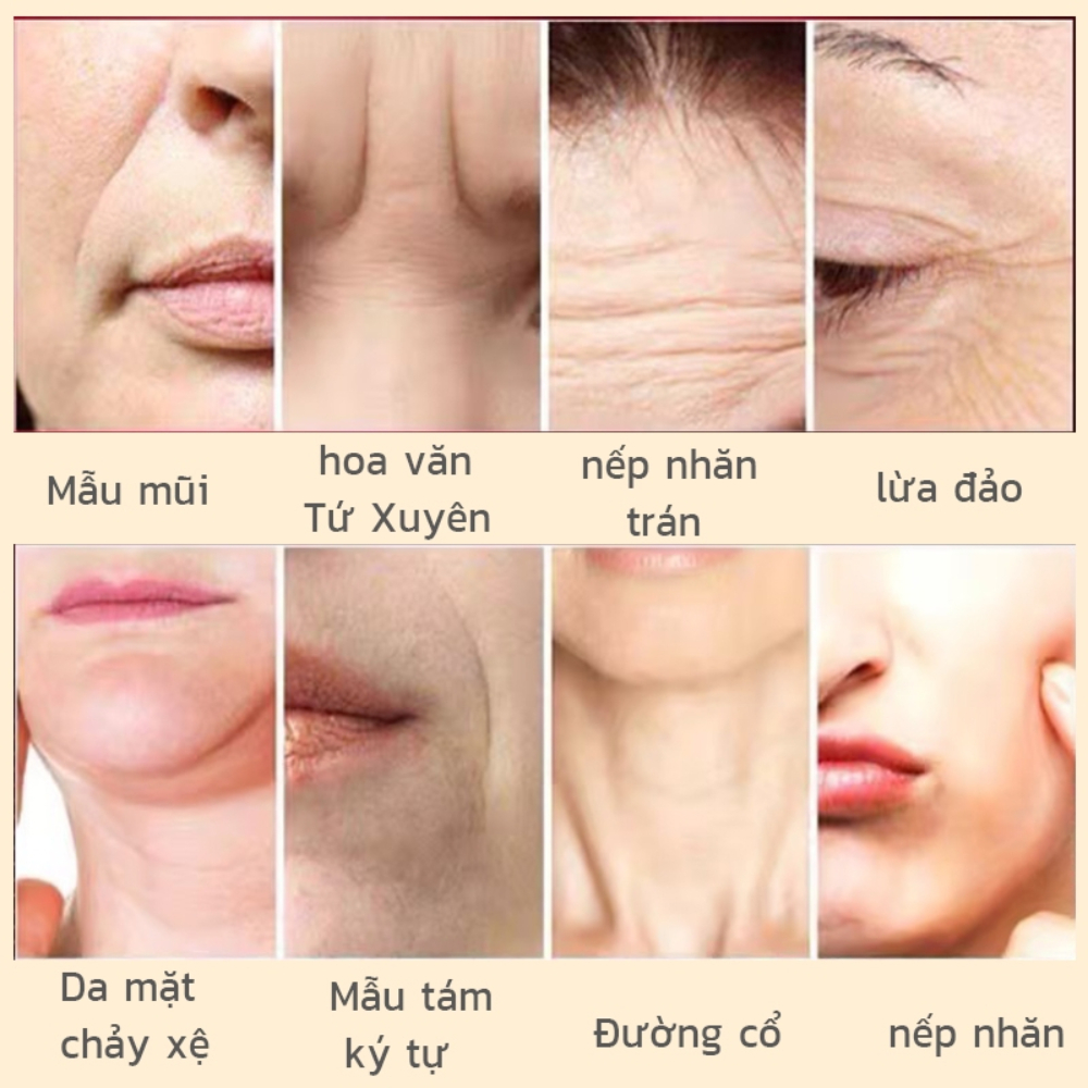Kem Trẻ Hóa Da Xóa Nhăn Collagen KHIO - KHIO Kem Xoá Nếp Nhăn Mắt, Rãnh Khi Cười, Trẻ Hoá Làn Da, Rạng Ngời Sắc Xuân