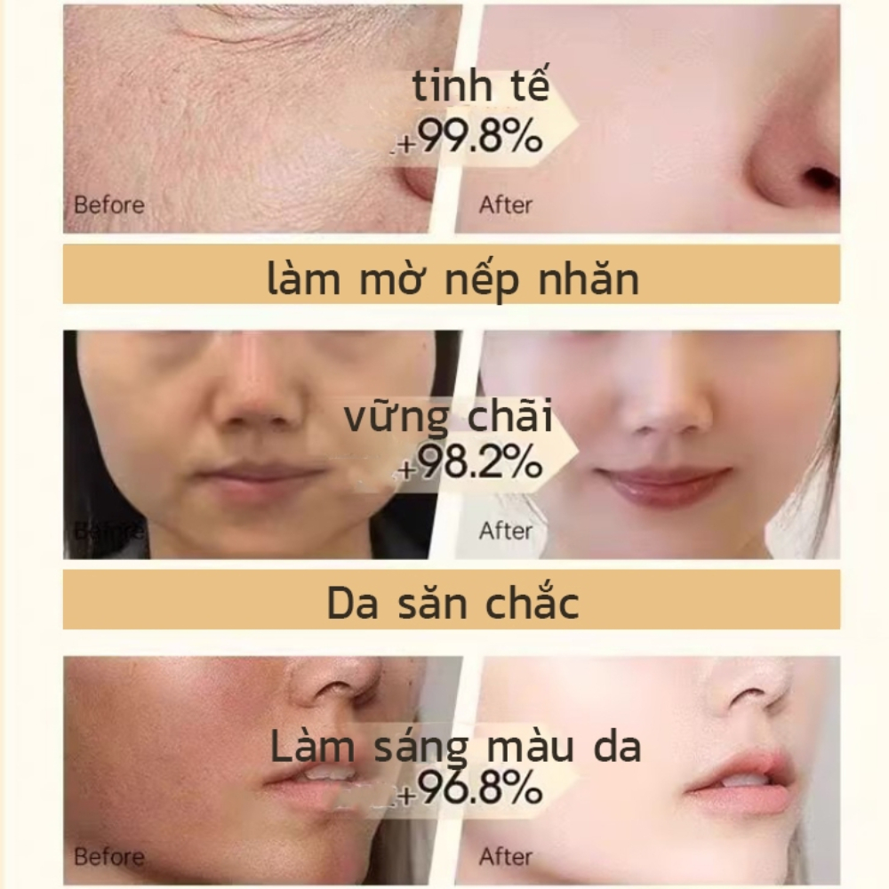 Kem Trẻ Hóa Da Xóa Nhăn Collagen KHIO - KHIO Kem Xoá Nếp Nhăn Mắt, Rãnh Khi Cười, Trẻ Hoá Làn Da, Rạng Ngời Sắc Xuân