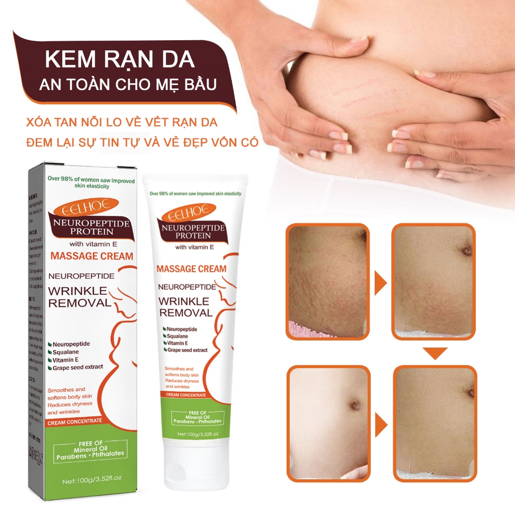 Kem Rạn Da An Toàn Cho Mẹ Bầu Trẻ Mới Lớn Hỗ Trợ Làm Trắng Giảm Sẹo Giúp Da Săn Chắc Mịn Màng EELHOE