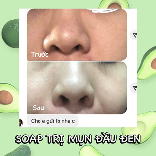 Xà phòng than tre rửa mặt handmade