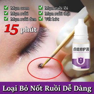 Tẩy nốt ruồi Thuốc mụn cóc Kem loại bỏ mụn cóc 10ml Tẩy nốt ruồi hiệu quả Nhanh chóng Không đau