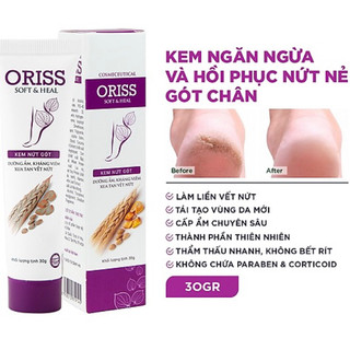 Kem nứt gót Oriss - 30gram