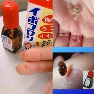 Kem xoá mụn cóc, mắt cá, chai chân Ibokorori 10ml Nhật Bản
