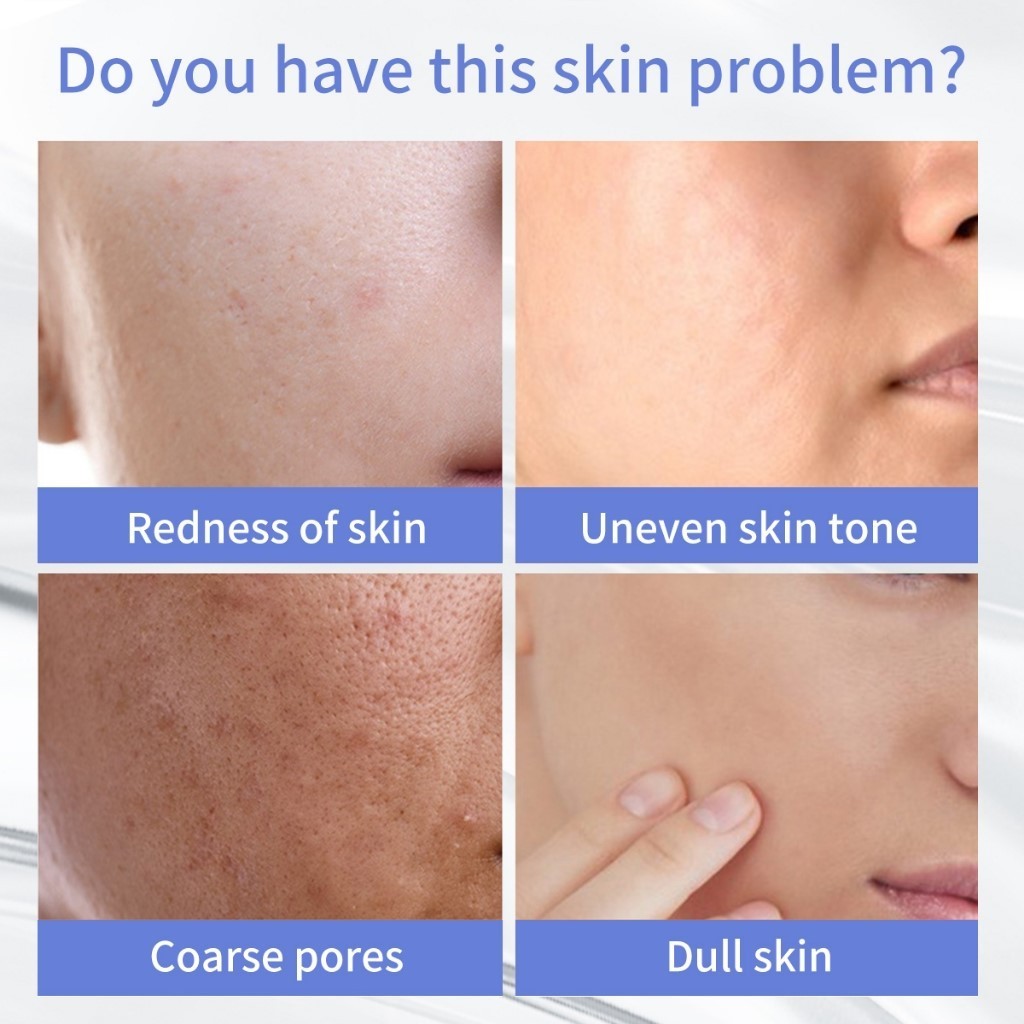 Serum Dưỡng Trắng Da Youbuy - Serum Youbuy Mờ Thâm Dưỡng Trắng Da, Se Khít Lỗ Chân Lông, Trẻ Hóa Da