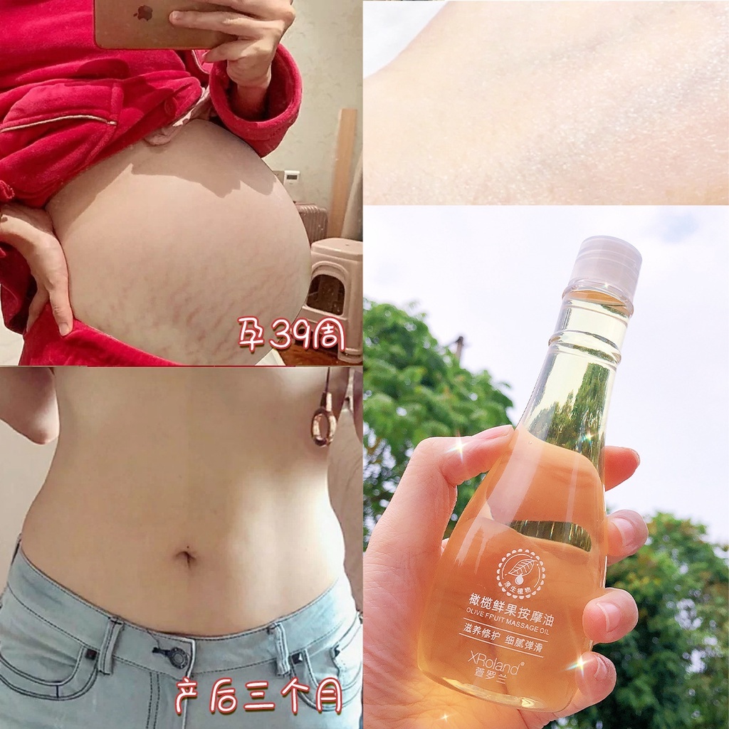 Tinh Dầu Rạn Da Oliu Xroland - Tinh Dầu Oliu Giúp Làm Mờ Rạn Da, Rạn Trắng, Rạn Đỏ, Phục Hồi Làn Da Mịn Màng, Săn Chắc