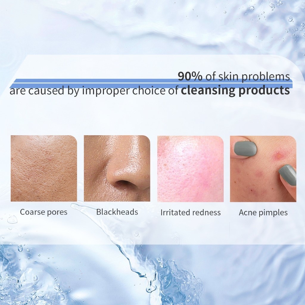 Sữa Rửa Mặt Youbuy - Sữa Rửa Mặt Youbuy Làm Sạch Sâu, Dưỡng Da Làm Da Sáng Và Mịn, Kiểm Soát Nhờn Dầu, Kháng Khuẩn