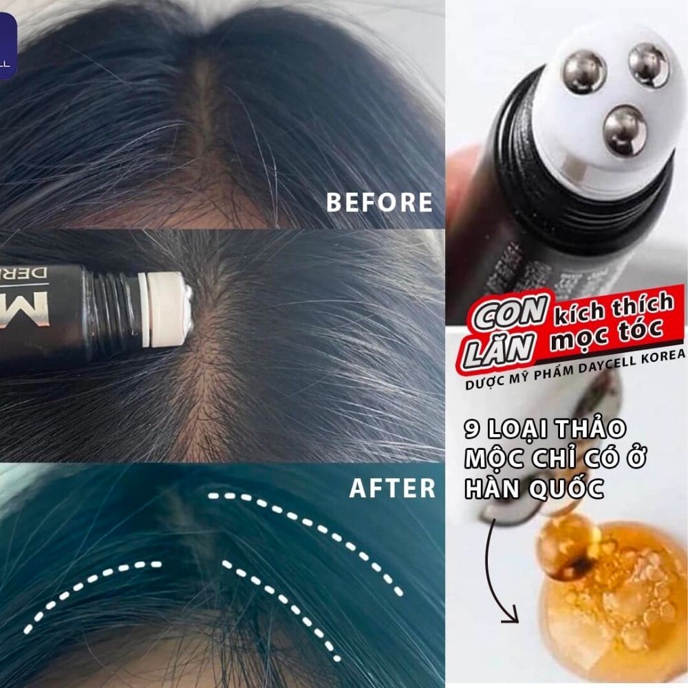 Thanh Lăn Giúp Mọc Tóc MBA Daycell - Lăn Thảo Dược MBA Kích Mọc Tóc Nhanh, Nuôi Dưỡng Da Đầu, Nang Tóc Chắc Khỏe