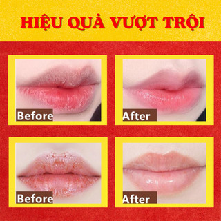 Tẩy Da Chết Môi Cafe Heyxi 15G