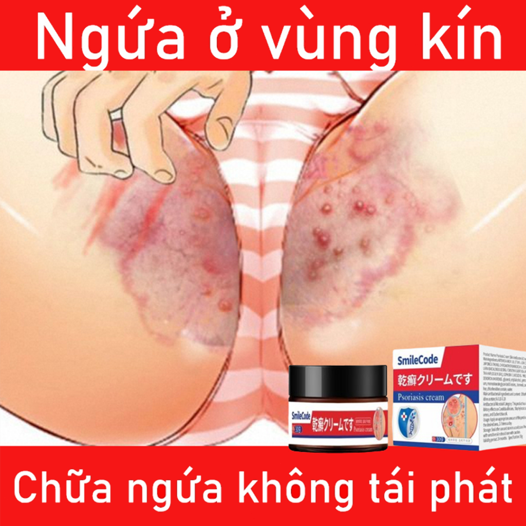 【Mua 2 tặng 1】Kem bôi nấm ngứa 30g hắc lào mề đay á sừng viêm da nấm da giải độc kem chống ngứa Kem bệnh chàm bệnh