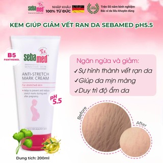 Kem ngăn ngừa rạn da bà bầu Sebamed Anti-Stretch Mark Cream pH5.5 (200ml)