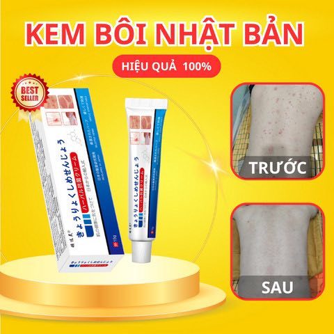 [nấm Nhật] Kem bôi nấm ngứa ngoài da nội địa trung(nấm nhật bản).hff