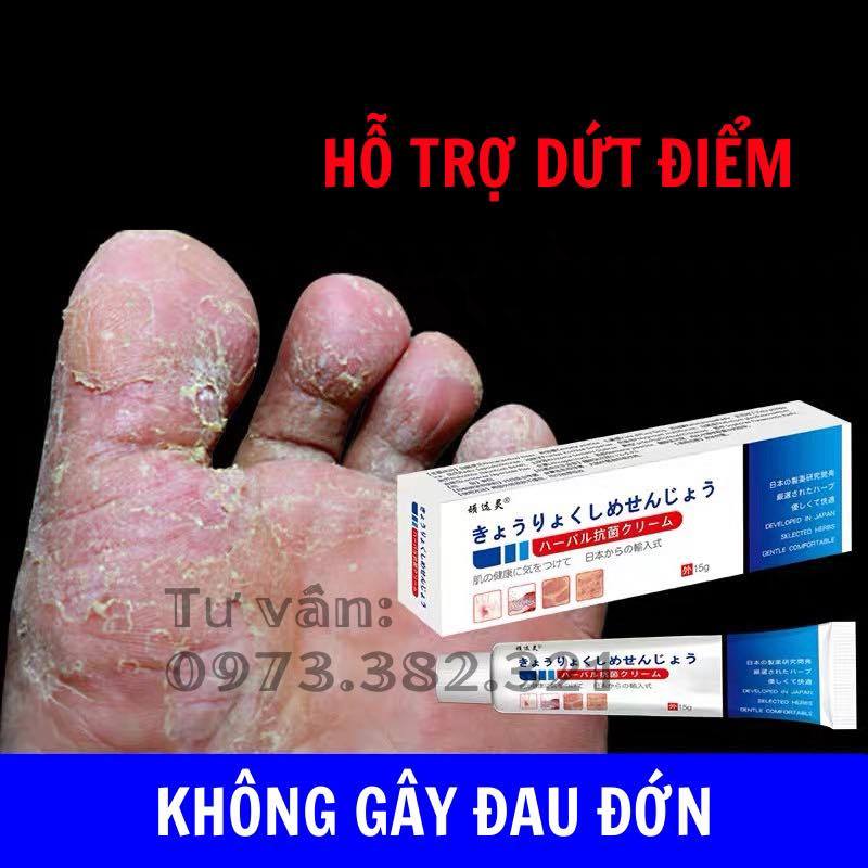 [nấm Nhật] Kem bôi nấm ngứa ngoài da nội địa trung(nấm nhật bản).hff