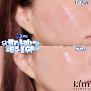 NẠ B5 EGF COMPLEX KR.LAB+