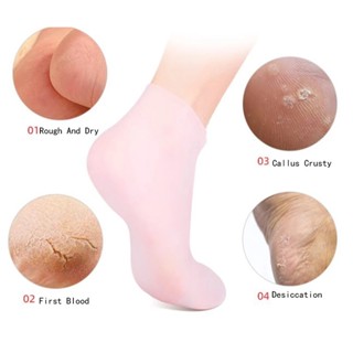  Hàng mới về  Cặp vớ silicon dưỡng ẩm chống nứt nẻ chuyên dùng cho bàn chân 