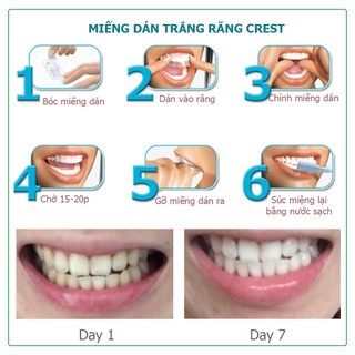 [Crest 3D] Miếng dán trắng răng White Professional Effects