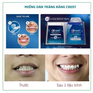[Crest 3D] Miếng dán trắng răng White Professional Effects