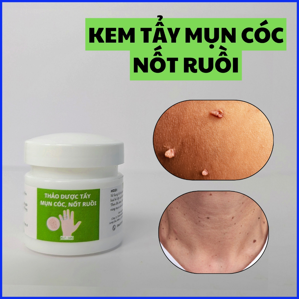 Kem Thảo Dược Tẩy Mụn Cóc - Mụn Thịt - Mụn Cơm - Nốt Ruồi 10g