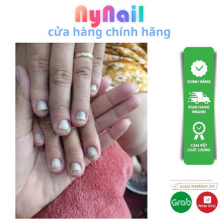 Nấm Móng away và varissi 15ml