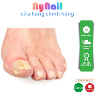Nấm Móng away và varissi 15ml