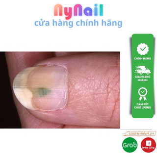 Nấm Móng away và varissi 15ml