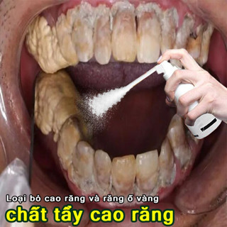 Xịt tẩy cao răng loại bỏ cao răng Làm trắng răng tẩy răng ố vàng sạch mảng bám răng làm mới hơi thở khử hôi miệng