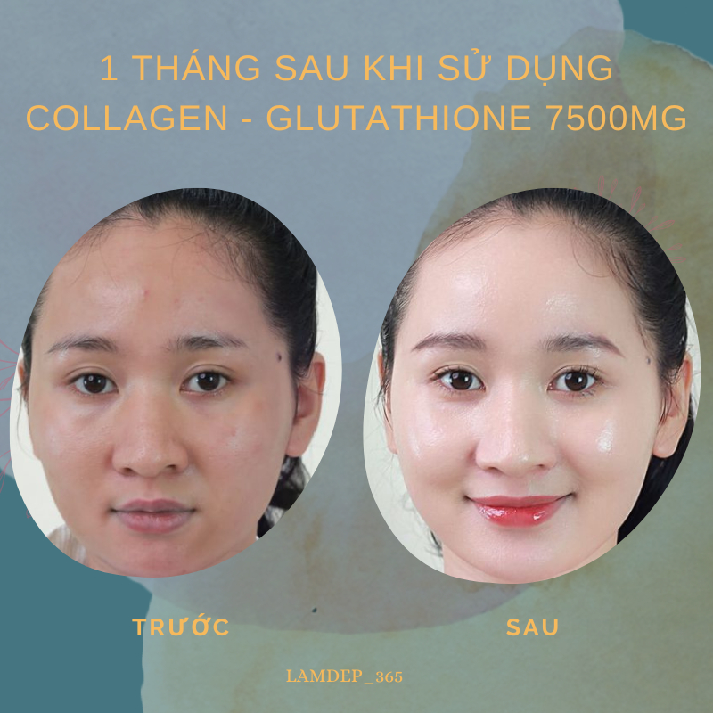 COLLAGEN - GLUTATHIONE 7500MG  viên uống trắng da chính hãng giảm thâm nám,nâng tông tức thì cân bằng nội tiết tố nữ.