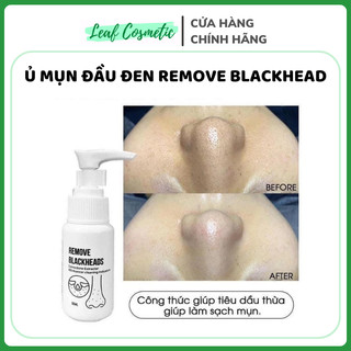 Ủ mụn làm sạch mụn đầu đen sợi bã nhờn remove blackhead