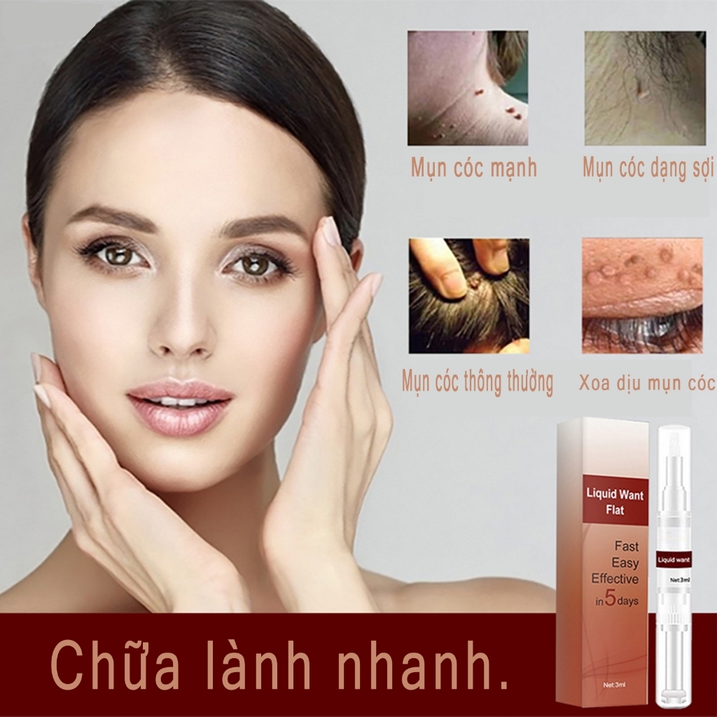 Kem Tẩy Nốt Ruồi Jaysuing - Giải Pháp Loại Bỏ Mụn Cóc, Mụn Cơm, Mụn Thịt Tại Nhà Không Để Lại Sẹo