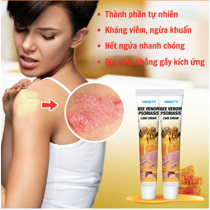 Kem Hbesty Bôi Tổ Đỉa, Mụn Nước - Kem Hbesty Giúp Giảm Ngứa, Sưng, Tổ Đỉa, Mụn Nước và Dưỡng Da Khỏe Mạnh