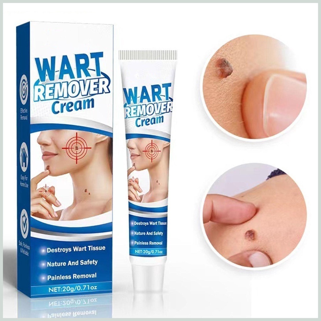 Kem Mụn Thịt Dư, Mụn Cóc Hbesty Wart Remover Cream - Kem Bật Gốc Cồi Mụn, Rụng Mụn Thịt Dư, Không Đau Ngứa