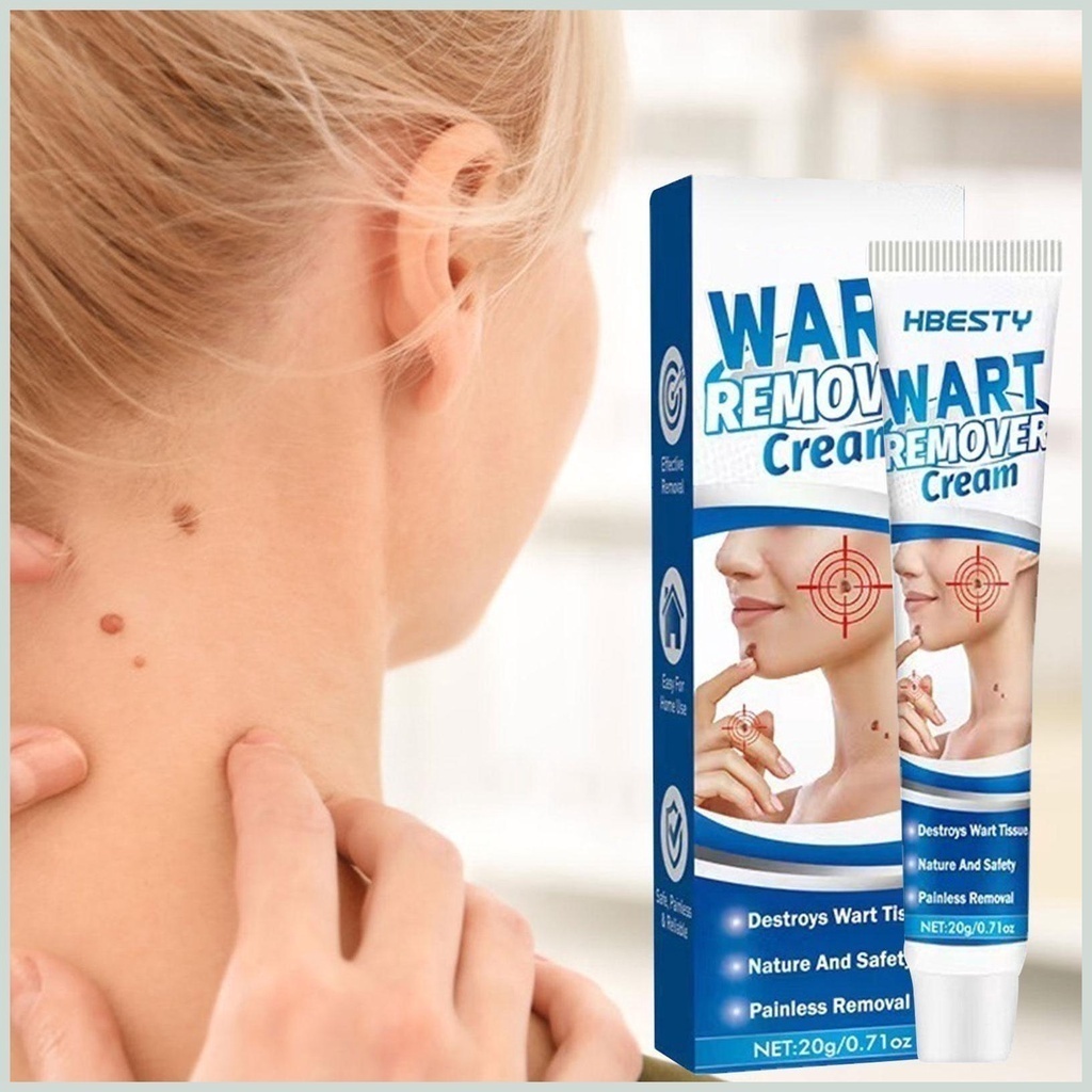 Kem Mụn Thịt Dư, Mụn Cóc Hbesty Wart Remover Cream - Kem Bật Gốc Cồi Mụn, Rụng Mụn Thịt Dư, Không Đau Ngứa