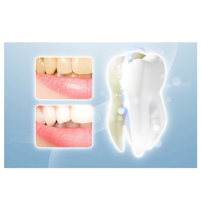 Kem Đánh Răng Jingxu Chunfu - Kem Chunfu Trắng Sáng Răng, Sạch Ố Vàng, Hết Hôi Miệng, Hơi Thở Thơm Mát