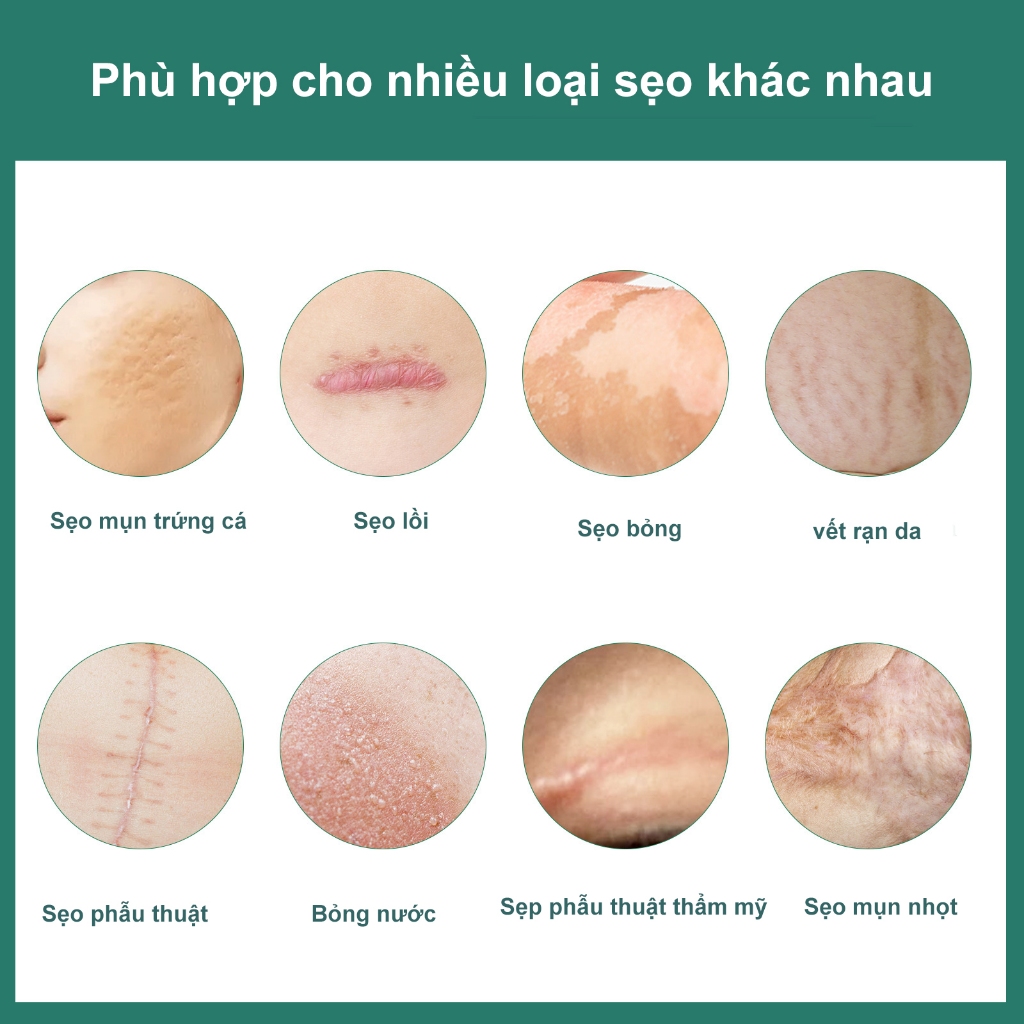 Kem Sẹo EELHOE Chính Hãng Làm Mịn Da và Phục Hồi Sẹo Phẫu Thuật Xóa Mờ Sẹo Phục Hồi Làn Da Bị Thương
