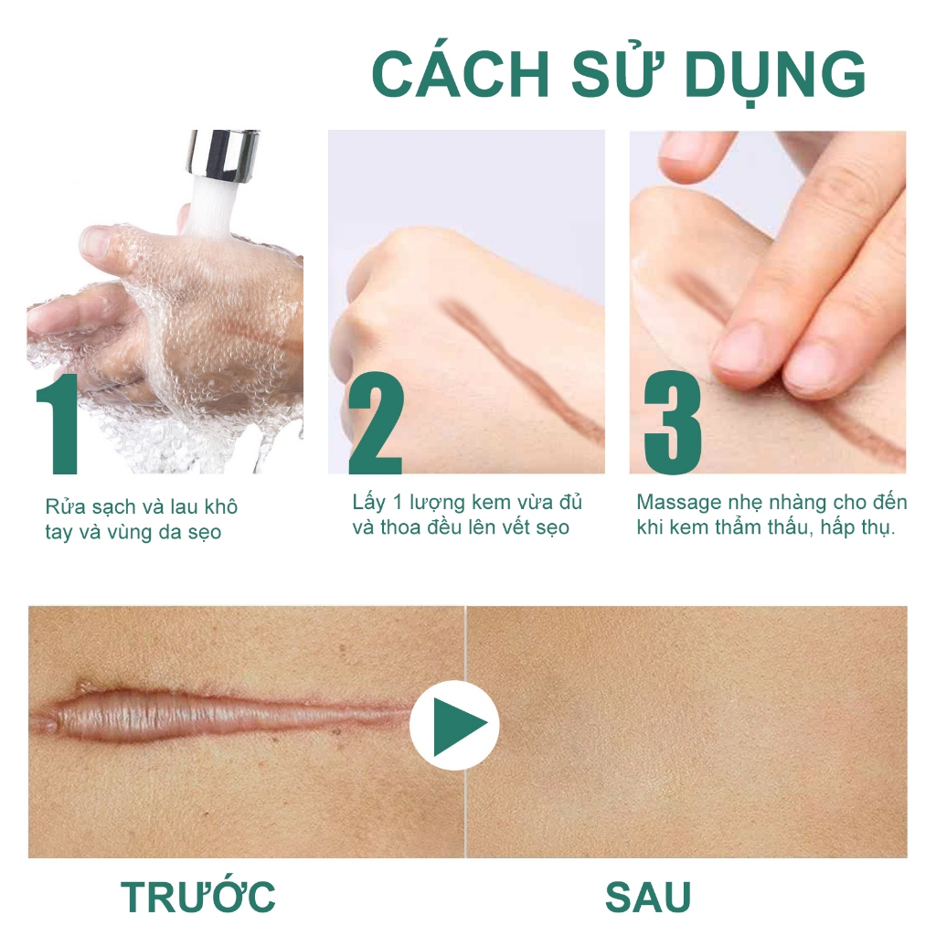Kem Sẹo EELHOE Chính Hãng Làm Mịn Da và Phục Hồi Sẹo Phẫu Thuật Xóa Mờ Sẹo Phục Hồi Làn Da Bị Thương