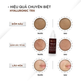 Tinh Chất Ekseption Hyaluronic TRX Mixlab Hỗ Trợ Sáng Da Mờ Nám Fullsize 75ml