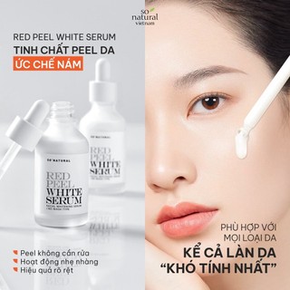 Tinh chất ức chế nám dưỡng trắng sáng da So Natural Red Peel White 35ml