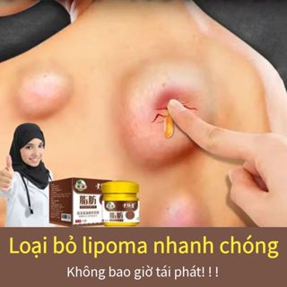  Kem tan u mỡ Kem bôi u bướu mỡ Kem tan hạch bạch huyết Kem tan mỡ Kem LoạI Bỏ U Mỡ Lipoma Cream Tan u cứng U mỡ 