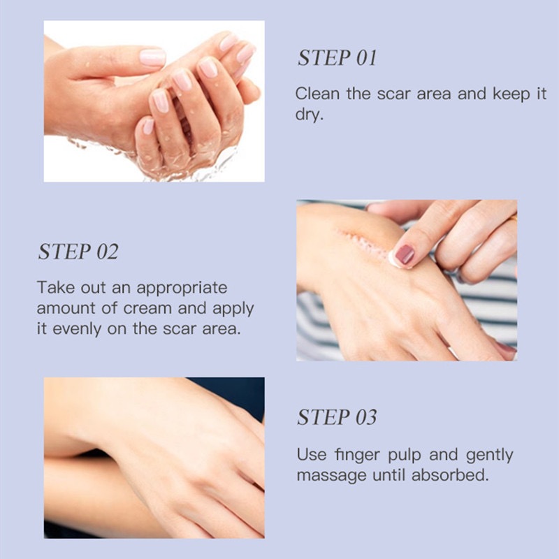 Kem Serum xóa sẹo, làm mờ sẹo lồi, sẹo rỗ, sẹo thâm mụn, sẹo lồi sẹo lõm B5 Gongpei 60gr  r lâu năm nhanh chóng tại nhà