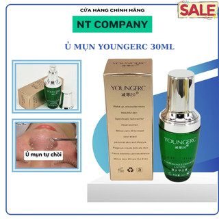 Ủ mụn Youngerc đầu đen, mụn cám Youngerc