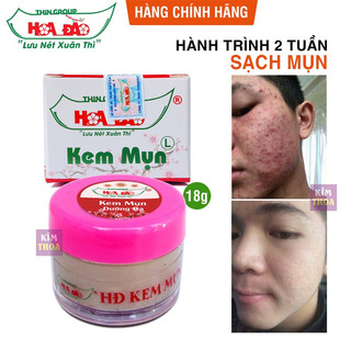 Kem mụn dưỡng da Hoa Đào Thingroup chính hãng 18g