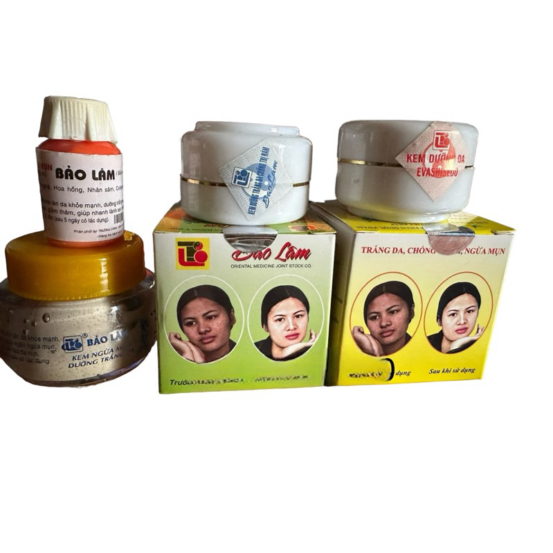 Kem Mụn trắng da Bảo Lâm 10g