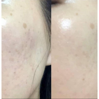 Serum Neoretin Discrom Control Booster