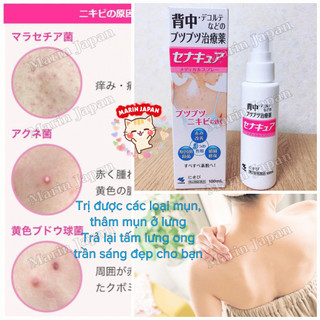 Xịt Mụn Lưng Senakyua Hiệu Quả Sạch Mụn Thâm Chính Hãng Nhật Bản