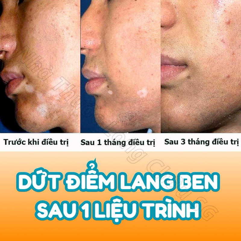 Kem Bôi Lang Ben Fango-B Thái Lan, Trị Hắc Lào, Nấm Da, Mẩn Đỏ, Ngứa, Tái Tạo Da (15gr) - chuẩn thái