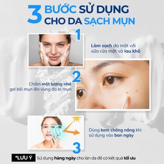 Gel Giảm Mụn Compliment SOS No Problem 25ml
