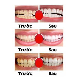 Kem đánh răng Colgate MaxFresh 10X Thái Lan 155g