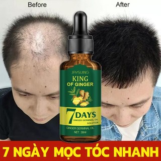 Serum mọc tóc Tinh chất dưỡng tóc Tinh Chất Chống Rụng Tóc 30ml kích thích mọc tóc nhanh làm dày giúp giảm rụng tóc giải